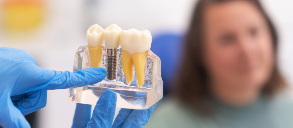 Why Should You Avoid Dairy After Dental Implants